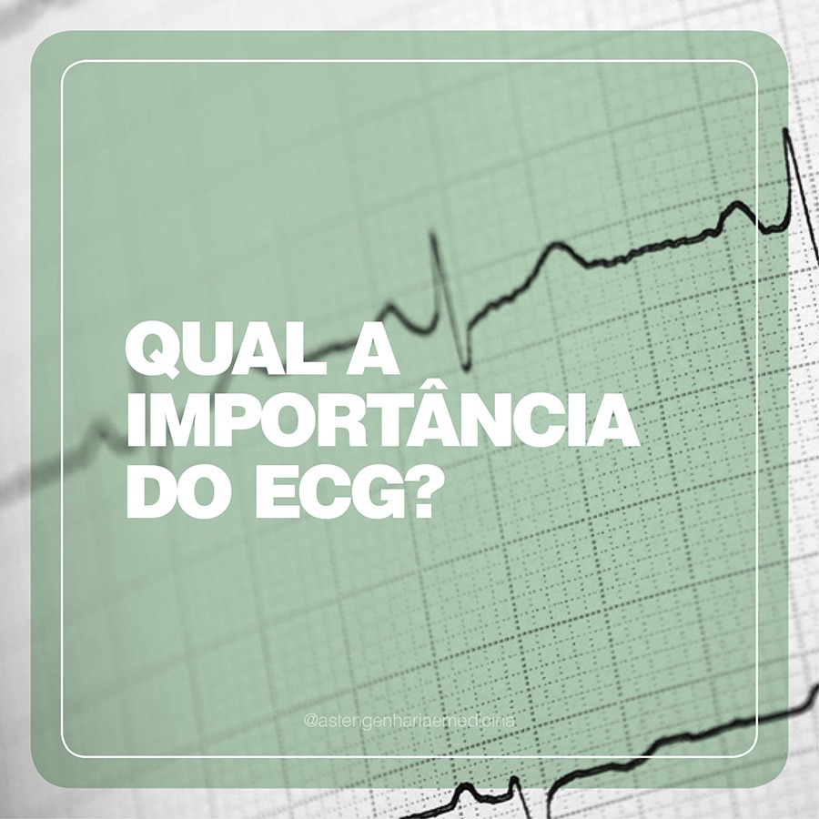 Qual a importncia do ECG?